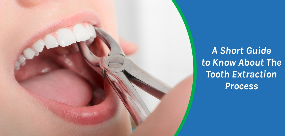 A Short Guide to Know About The Tooth Extraction Process